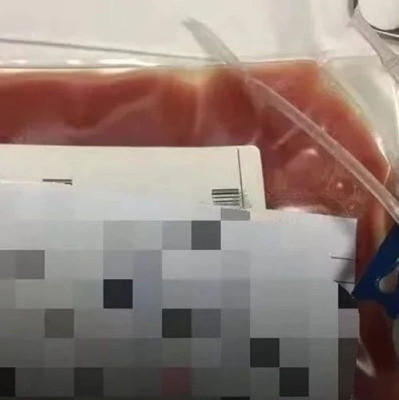 如果确诊，刚出生1个月的女儿生存期可能只剩9个月了