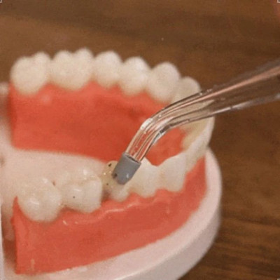 千万别天天用冲牙器，真怕你......