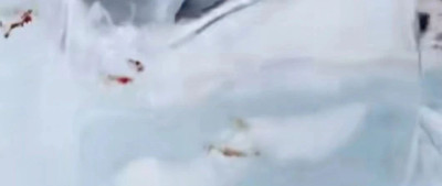 “全是嘴唇血印”，千万别试！医生紧急提醒