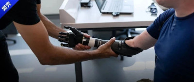 第一批当上“赛博格”的人，已经过了保修期