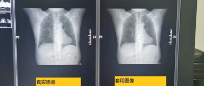 恶意对抗调查！医保局通报