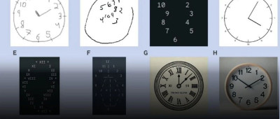医学检查显示，顶尖AI基本都有认知障碍，还病得不轻