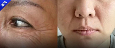 哪有什么“断崖式衰老”，卷医美不如做好这件事