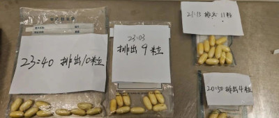 人体藏毒123粒，被海关查获！