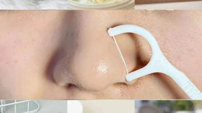 奉劝那些天天折腾鼻子的人：黑头贴、小气泡不能去黑头！