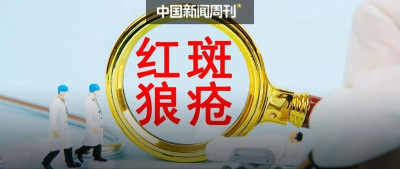 红斑狼疮，还是高致死性疾病吗？