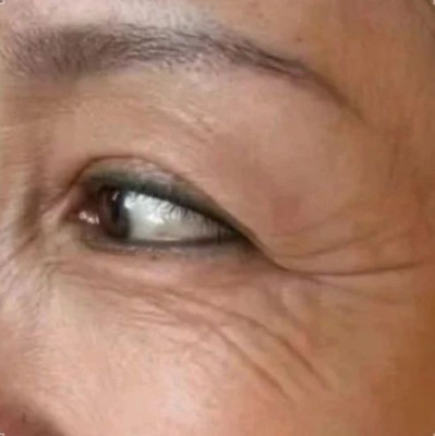 哪有什么“断崖式衰老”，卷医美不如做好这件事