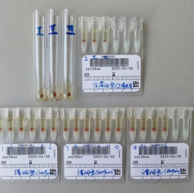 发现1例“恐龙血”！这类人早做准备