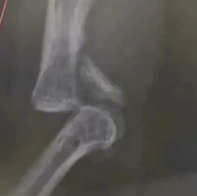 惊险抓捕！这张照片，令人心疼