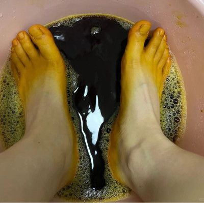 讲真，千万不要乱涂碘伏！千万不要！