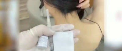 女子打“瘦肩针”导致中毒，祸起成本仅1块5的肉毒素……