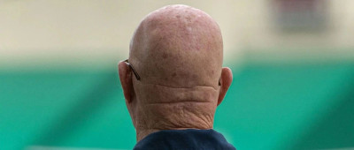 间歇性禁食可能会抑制头发生长；预训练大模型“走入死胡同”，OpenAI前首席科学家Ilya会上宣布 | 环球科学要闻