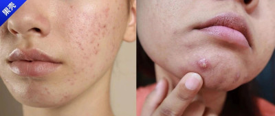 人为什么一过节就变丑了？原因竟然是这个……