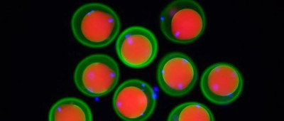 精子和卵子的最初结合，是如何发生的？