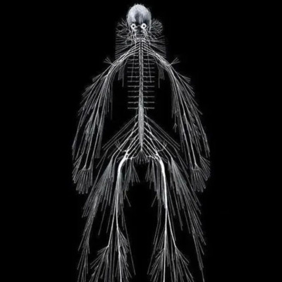 胆小慎入：把人全身的神经都抽出来，会得到什么？