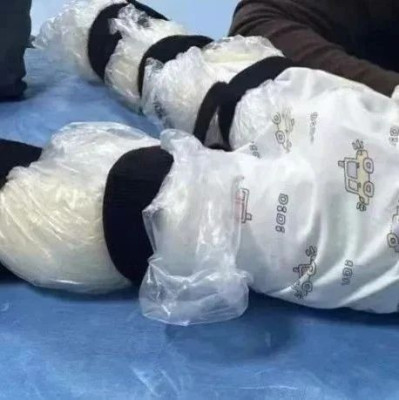 鹤腿，也像倒置香槟酒瓶……儿子的腿以后真会萎缩成那样吗？