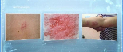 拆快递揉了一下眼睛就被感染！紧急提醒→