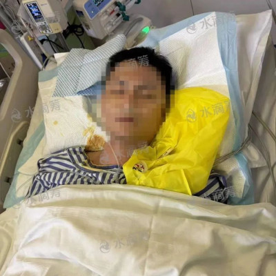 3人吃癞蛤蟆中毒，1人死亡2人仍在救治