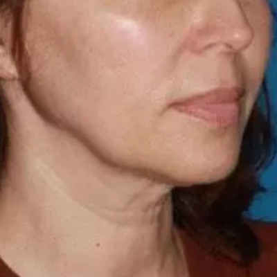 讲真话｜拯救断崖式衰老，这几十块的小东西真牢牢拴住了我