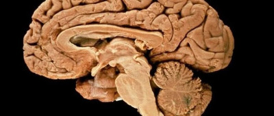 人脑为何能这么大，因为脑细胞够抗压？