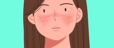 红斑狼疮是绝症吗？常规体检能否发现？你想了解的都在这里→