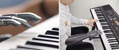 为帮他们“长”出手臂，这位博士每天洗4次头